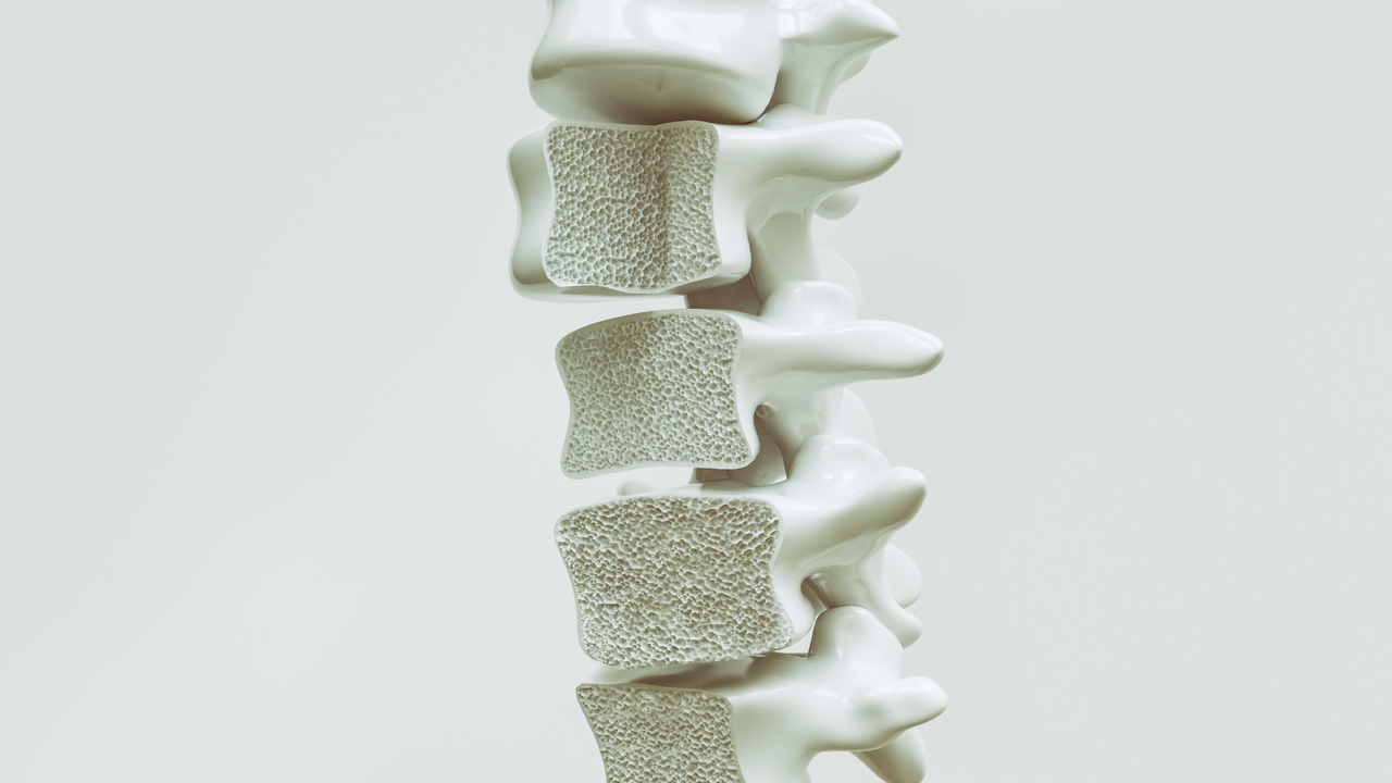 cichy złodziej kości - osteoporoza leczenie gdańsk